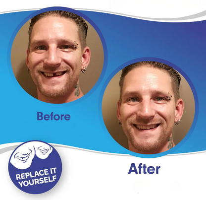 Clip On Veneer with Adjustable Silicone Strip and Storage Case