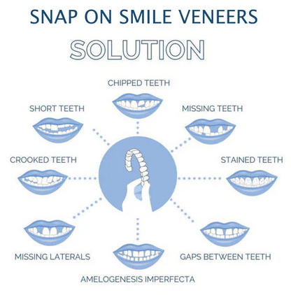 Clip On Veneer with Adjustable Silicone Strip and Storage Case