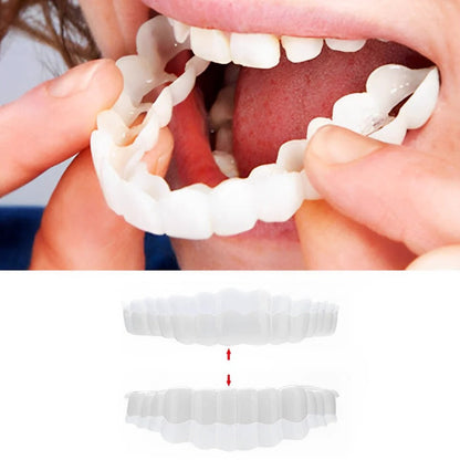 Clip On Veneer with Adjustable Silicone Strip and Storage Case