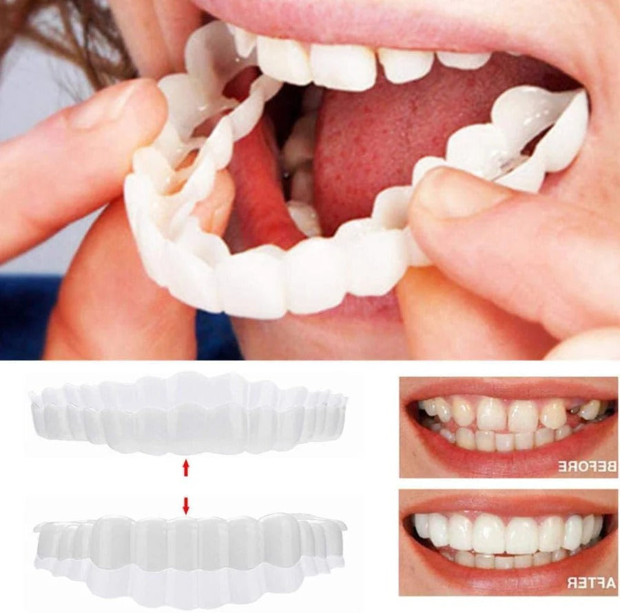 Clip On Veneer with Adjustable Silicone Strip and Storage Case